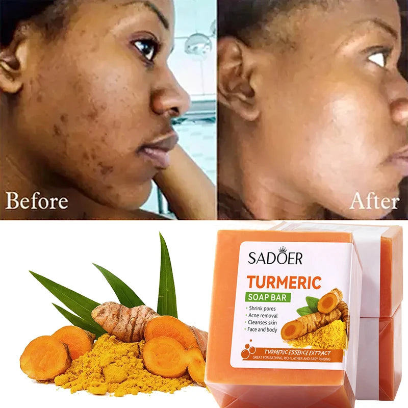 Kojic Acid Dark Spot Remover Soap – Turmeric Natural Face & Body Cleansing Bar