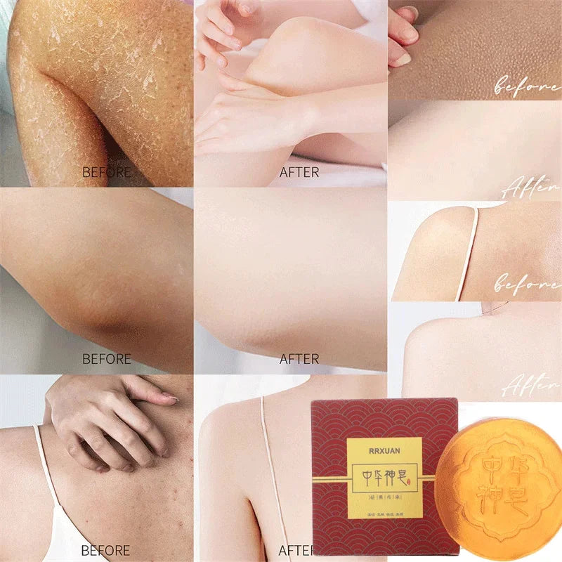 Body Whitening Soap – Deep Clean & Skin Brightening Care