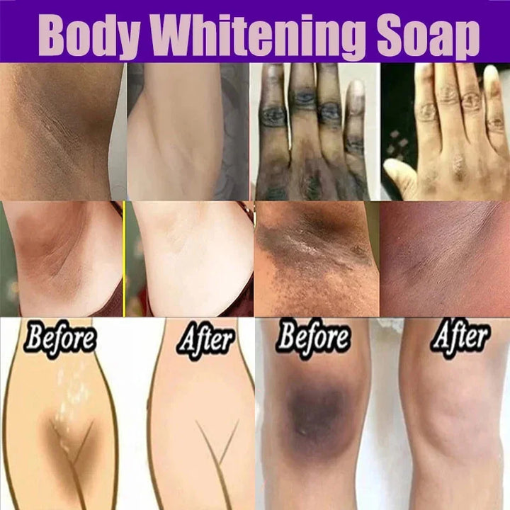 Body Whitening Soap – Deep Clean & Skin Brightening Care
