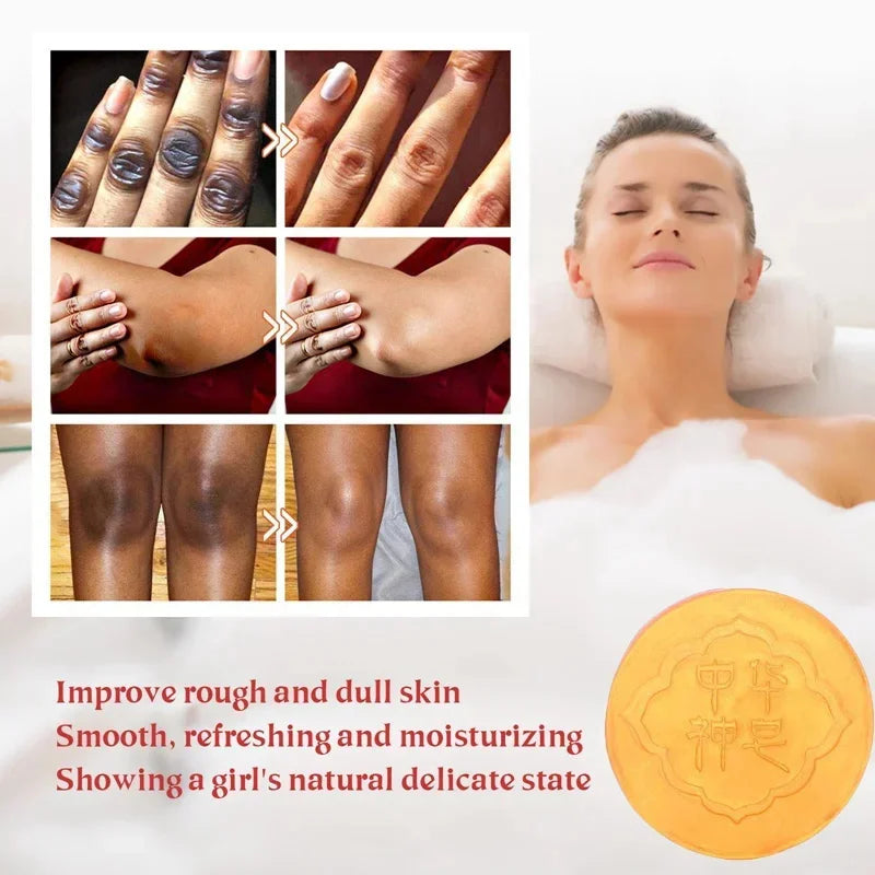 Body Whitening Soap – Deep Clean & Skin Brightening Care